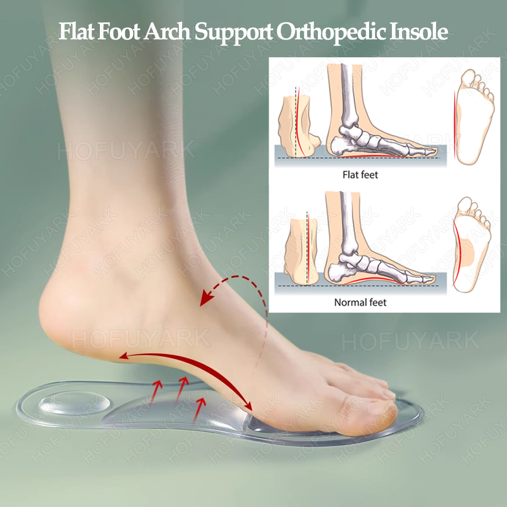 Silicone Gel Insoles Orthopedi - Women'S Shoes Plantar Fasciitis recension och pris
